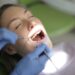 reasons for dental implants