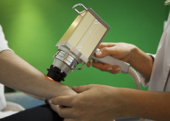 moles that lead to skin cancer