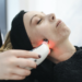 laser facial treatments